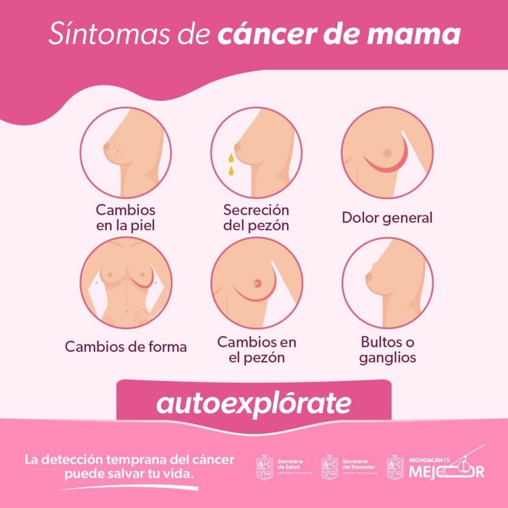Reconoce los síntomas del cáncer de mama para actuar de inmediato 2 b8afc45c adc7 4c9c af99 ac3ed606c833